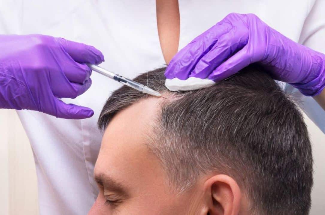 Hair Transplant Turkey: Achieve Natural-Looking Hair Today
